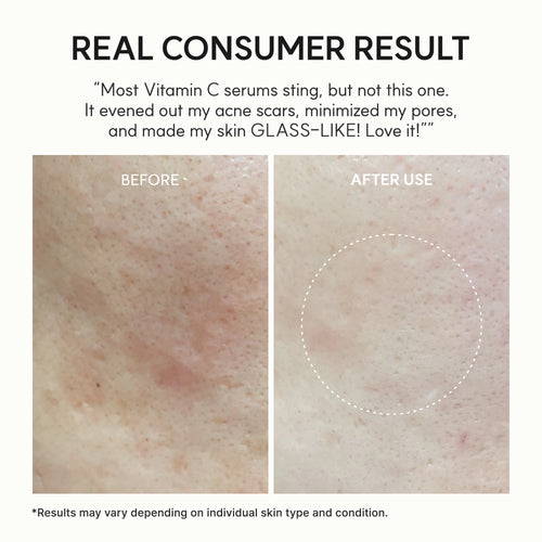 Arencia Serum Vitamin C